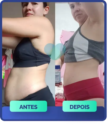 antesedepois-03-5