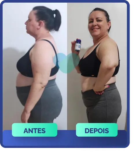 antesedepois-04